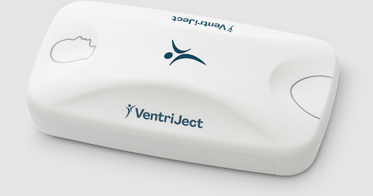 Ventriject